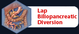 Lap Biliopancreatic Diversion